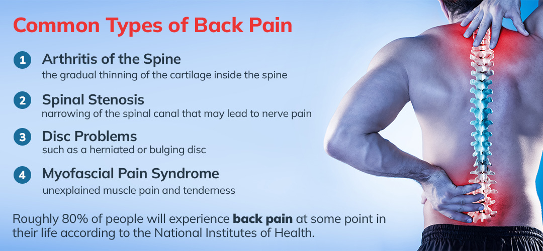 7 Ways to Treat Chronic Back Pain Without Surgery